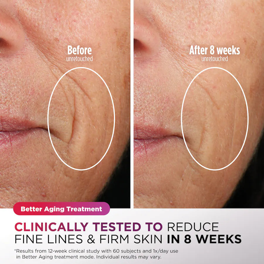 Shark CryoGlow Under-Eye Cooling + LED Face Mask, Blue Frost